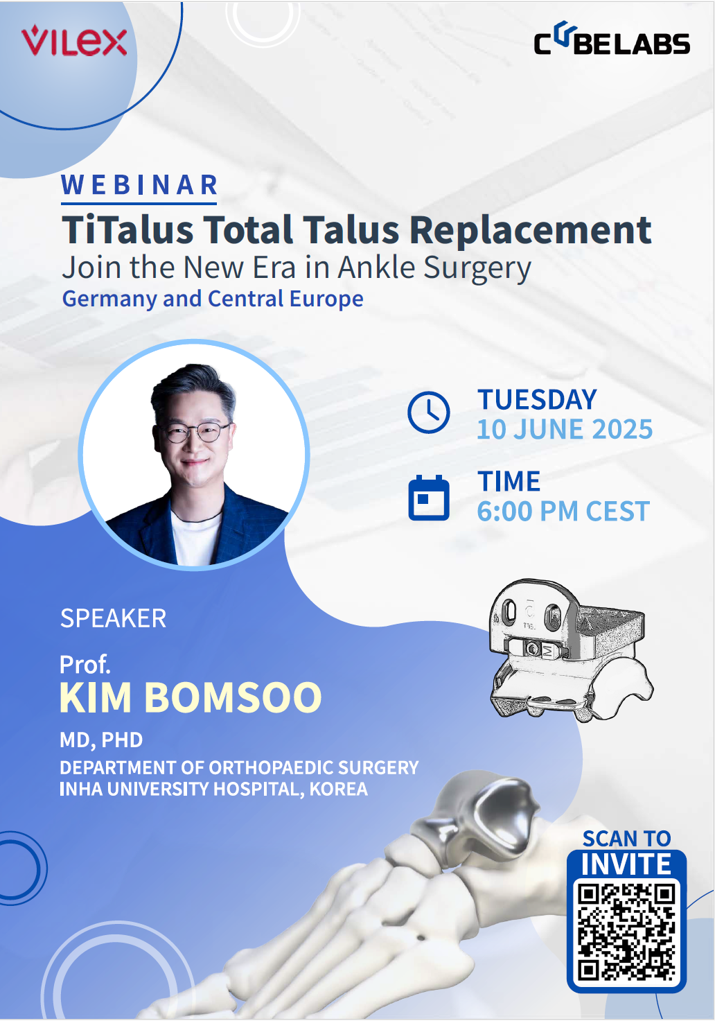 Webinar Announcement: TiTalus – Patient-Specific Total Talus Replacement